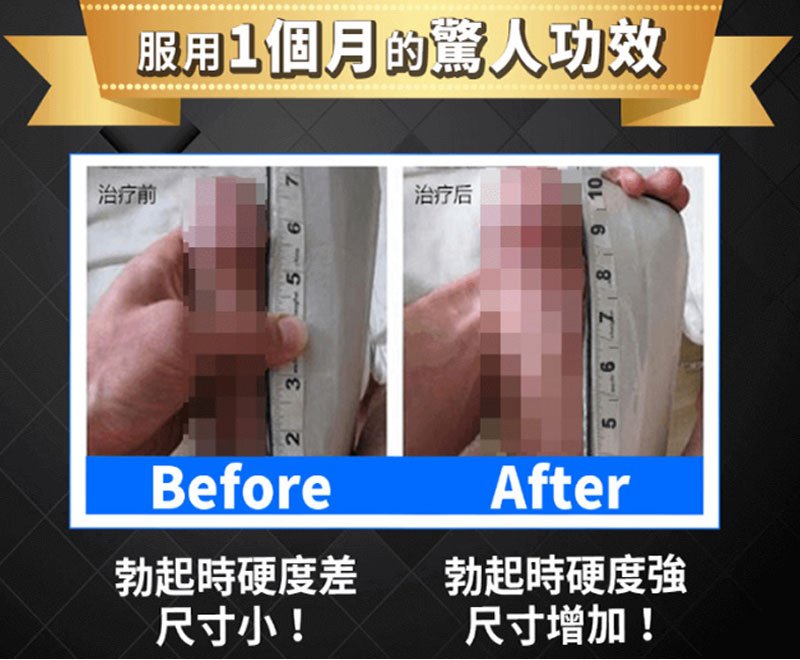 Before After 對比